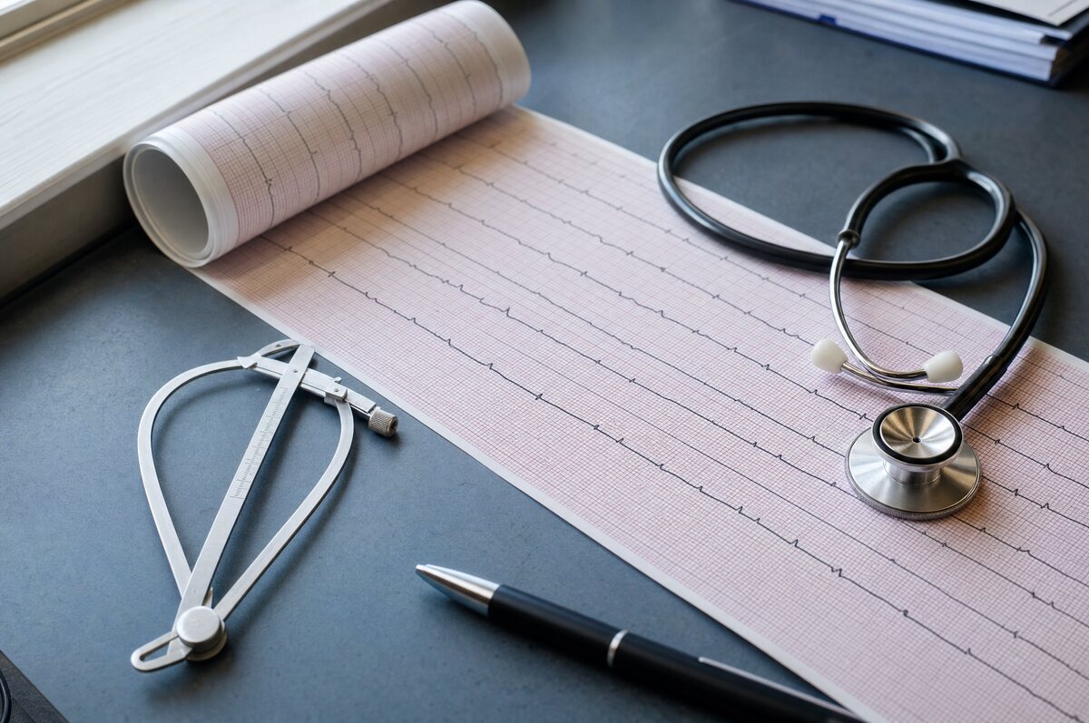 Tira de papel de eletrocardiograma desenrolada sobre uma mesa, com o traçado impresso, um compasso de medida, uma caneta e um estetoscópio.